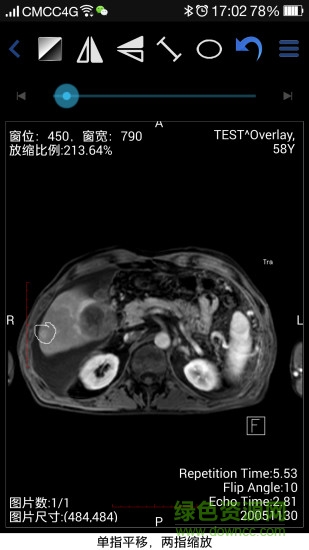 醫(yī)影在線手機版app(醫(yī)影云)0