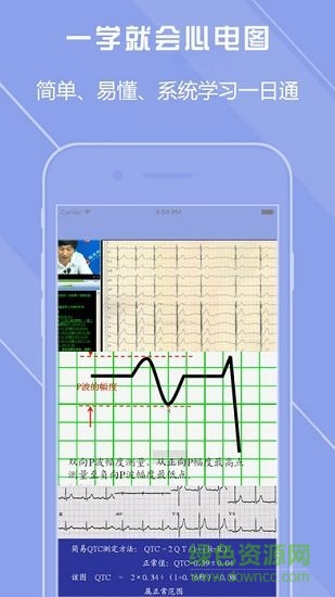 心電圖譜下載