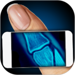 模拟器x射线手指笑话app