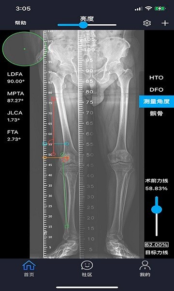 華保膝望官方版1