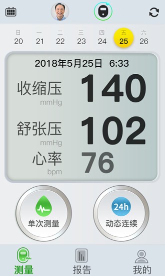 无袖带血压计长桑app v1.0.9.103 安卓版2