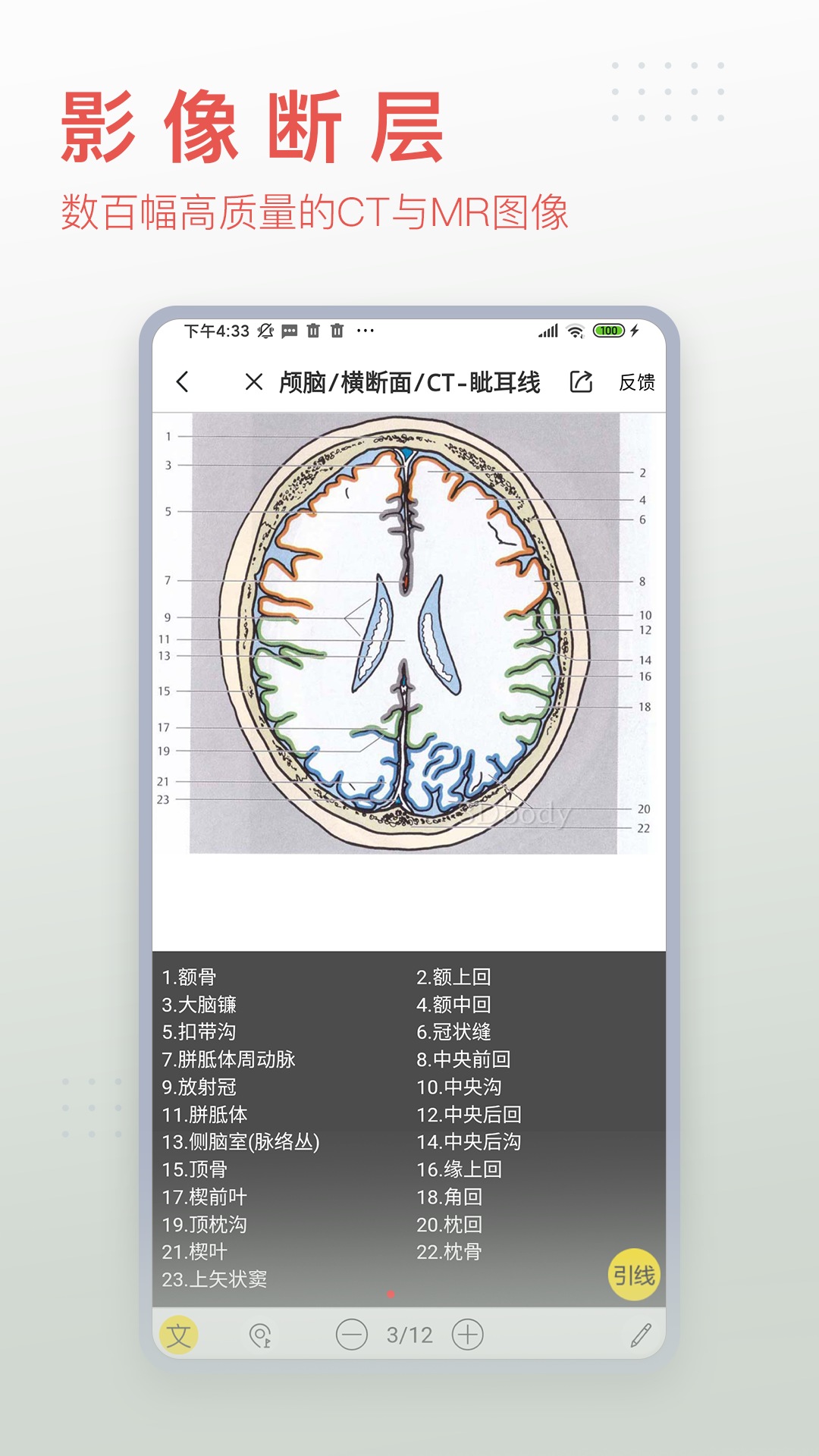 3dbody三维免费人体解剖软件 v8.8.13 官方安卓版2