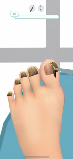 腳趾診所 v1.1.1 安卓版 1