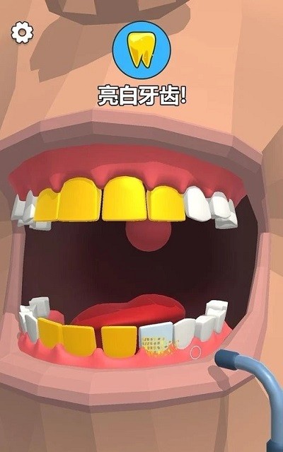 拔牙嗎我賊6 v0.1.2 安卓版 0