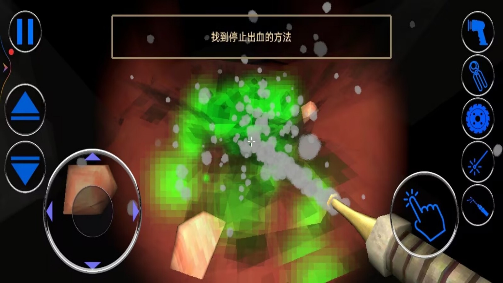 腸胃醫(yī)院 v1.0 安卓版 1