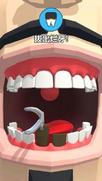 拔牙大師 v0.1.2 安卓版 2