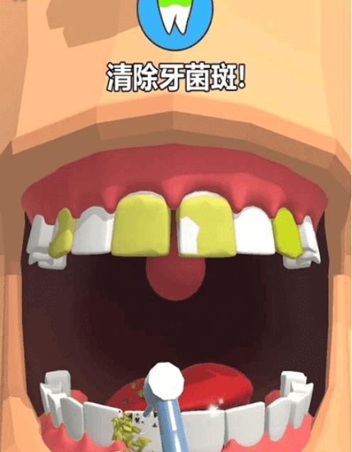 洗牙 v0.1.2 安卓版 0