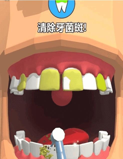 洗牙 v0.1.2 安卓版 1